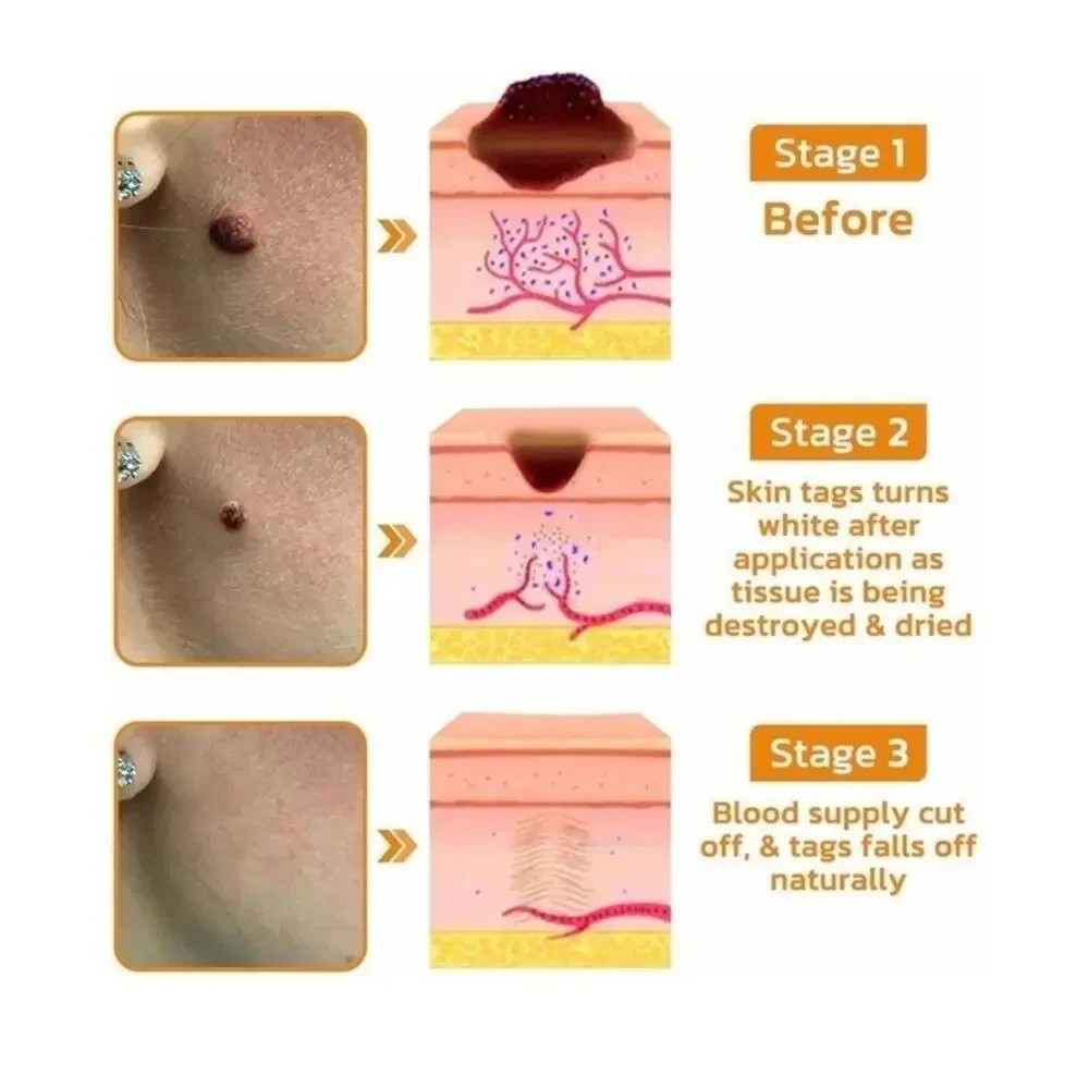 Bee Venom Skin Restoration Cream, Professional Bee Venom Skin Treatment Cream